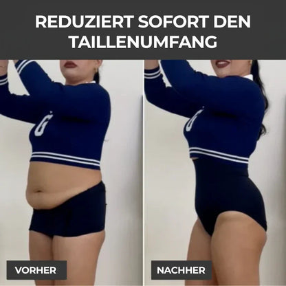 Cellumove 3D Leggings – Verabschieden Sie sich auf natürliche Weise von Lipödemschmerzen und Schwellungen.