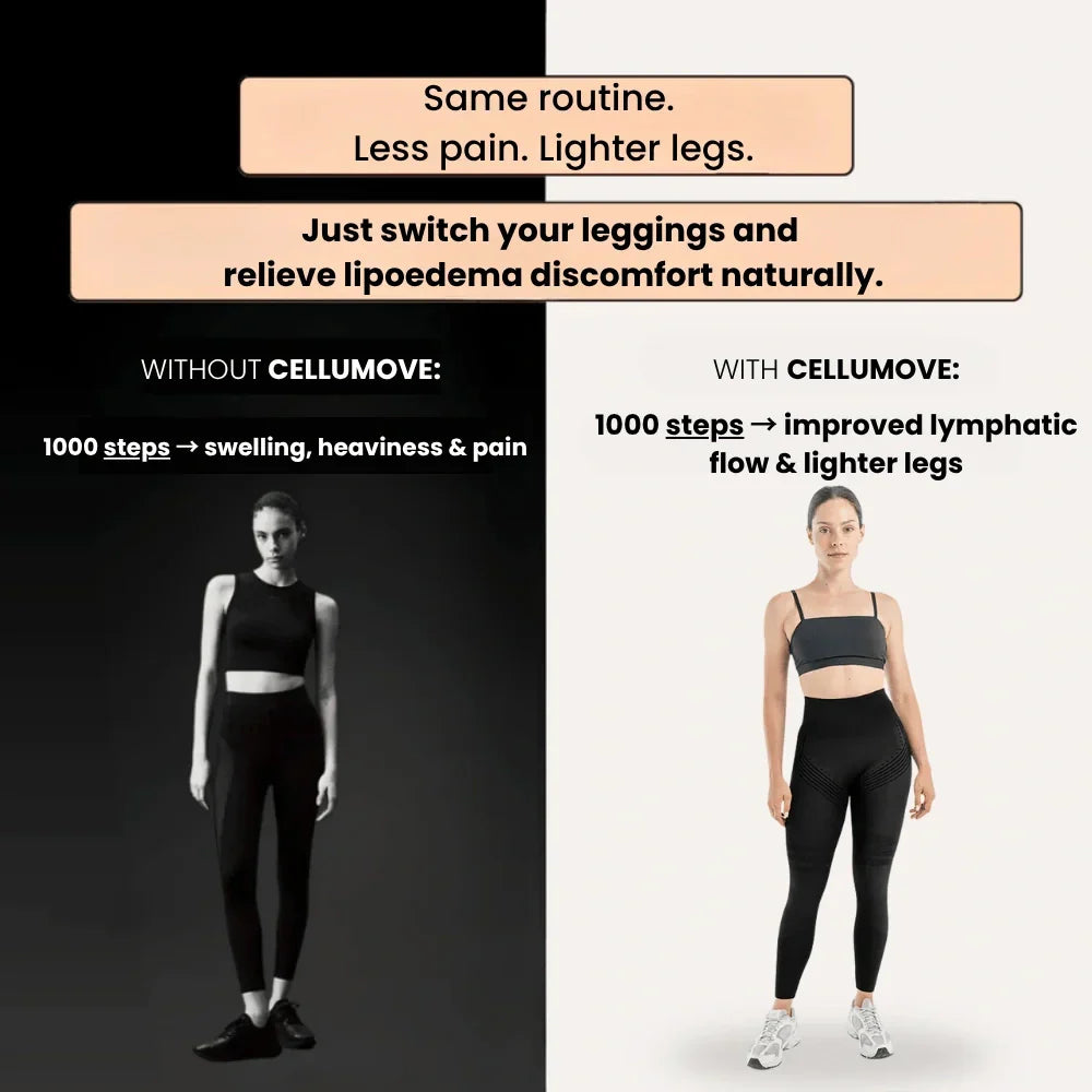 Cellumove 3D Leggings – Verabschieden Sie sich auf natürliche Weise von Lipödem-Schmerzen und Schwellungen.