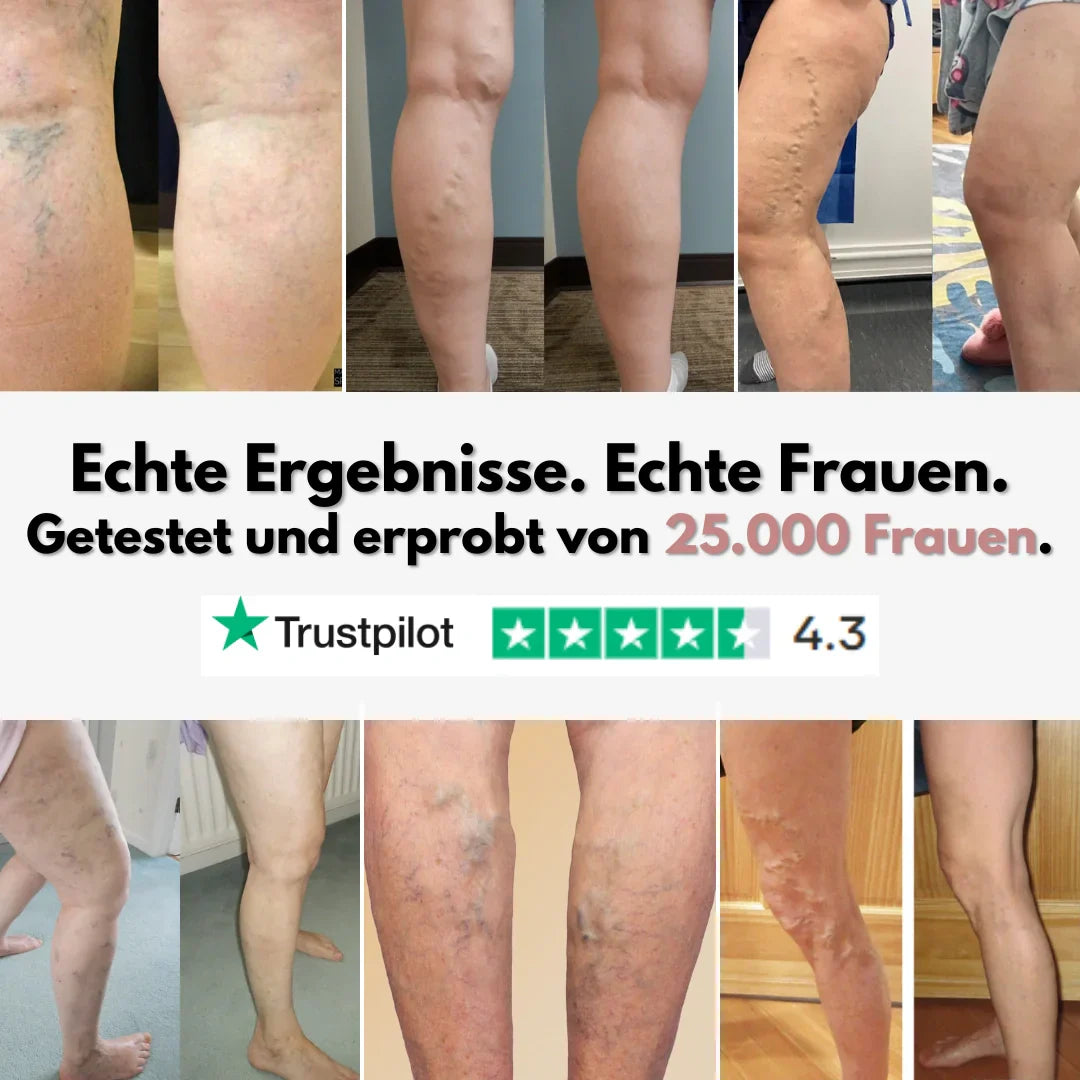 Cellumove 3D Legging – Entlasten und beugen Sie Krampfadern auf natürliche Weise vor.